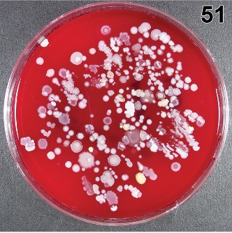 Bacteria Cultured from “Clean” Mattress after Terminal Cleaning.11